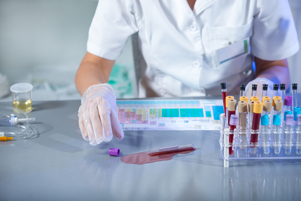 Accidents in the laboratory. Scientists spilled test tube with infected blood