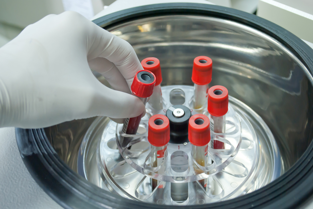 lab worker putting vile of blood into lab centrifuge